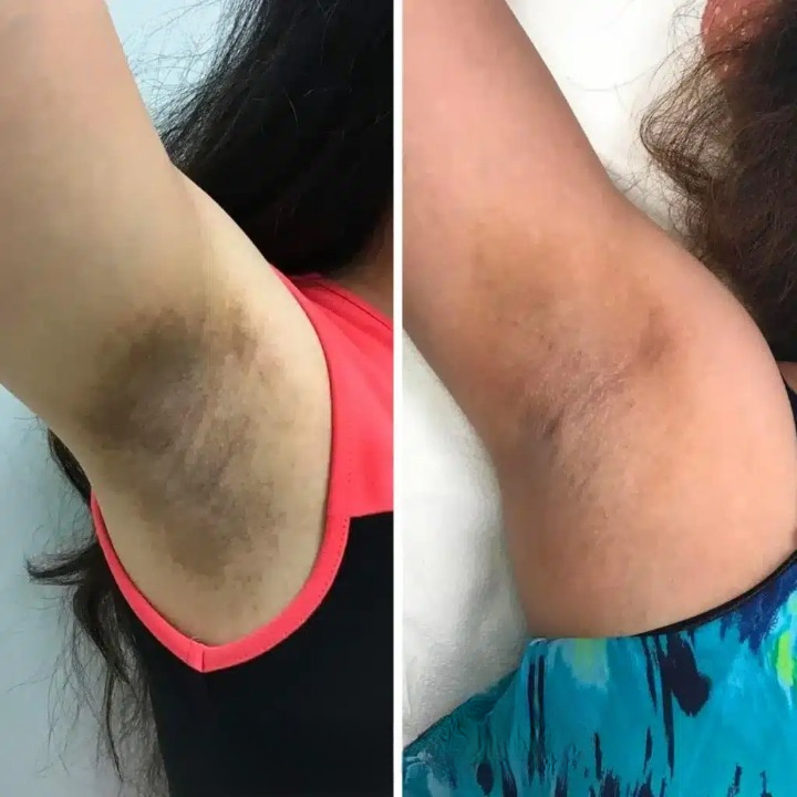Arencia كريمة التفتيح